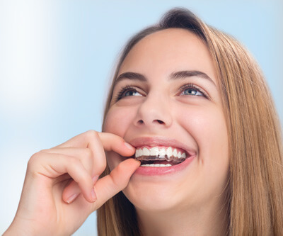 girl inserting a clear aligner onto her top row of teeth