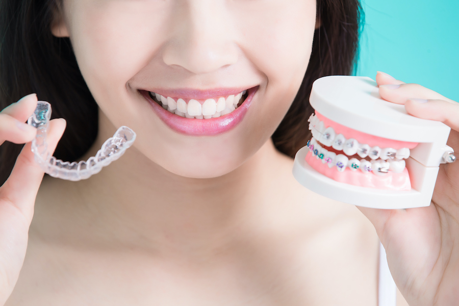 A woman holds up a mouth model with braces next to clear aligners